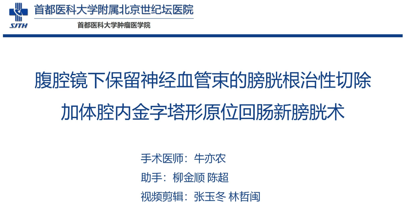 腹腔镜下保留神经血管束的膀胱根治性切除加体腔内金字塔形原位回肠新膀胱术