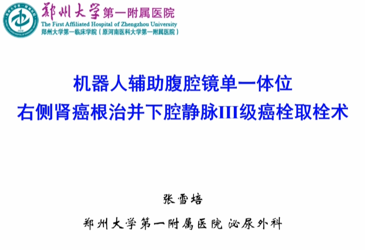 【2023-1期】机器人辅助腹腔镜单一体位右侧肾癌根治并下腔静脉Ⅲ级癌栓取栓术